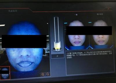 皮膚檢測儀深度實測 Visia、美圖宜膚、A-one究竟哪家強？